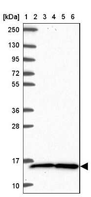 Western Blot: TAX1BP3 Antibody [NBP2-38016]