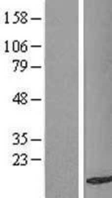 Western Blot: TAX1BP3 Overexpression Lysate [NBL1-16717]