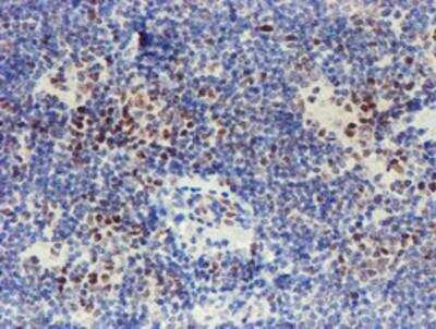 Immunohistochemistry-Paraffin: TAZ/WWTR1 Antibody (OTI1H9) [NBP2-01209]