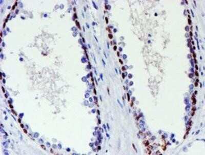 Immunohistochemistry: TAZ/WWTR1 Antibody (OTI1H9) - Azide and BSA Free [NBP2-74449]