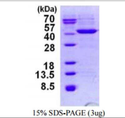 SDS-PAGE: Recombinant Mycobacterium tuberculosis Ab85A His Protein [NBP1-99035]