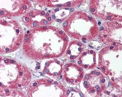 Immunohistochemistry-Paraffin: TBC1D1 Antibody [NBP1-54654]