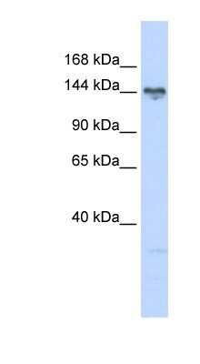 Western Blot: TBC1D1 Antibody [NBP1-54654]