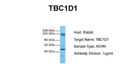 Western Blot: TBC1D1 Antibody [NBP1-54654]