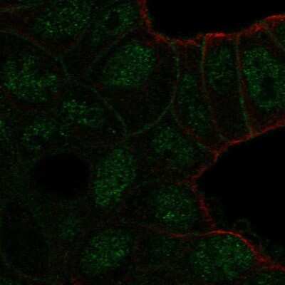Immunocytochemistry/ Immunofluorescence: TBC1D10A Antibody [NBP2-58911]