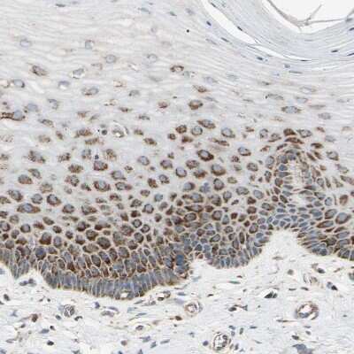 Immunohistochemistry-Paraffin: TBC1D10A Antibody [NBP1-89294]