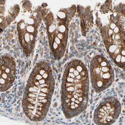Immunohistochemistry-Paraffin: TBC1D10A Antibody [NBP1-89294]