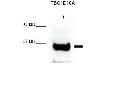 Western Blot: TBC1D10A Antibody [NBP1-79842]