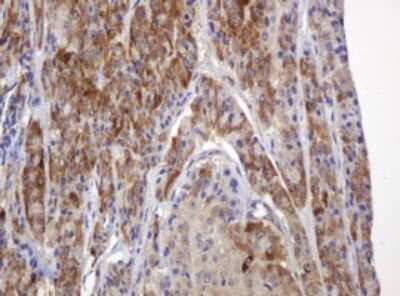 Immunohistochemistry: TBC1D13 Antibody (OTI2C5) [NBP2-45985]