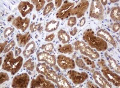 Immunohistochemistry: TBC1D13 Antibody (OTI2C5) [NBP2-45985]