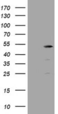 Western Blot: TBC1D13 Antibody (OTI2C5) [NBP2-45985]