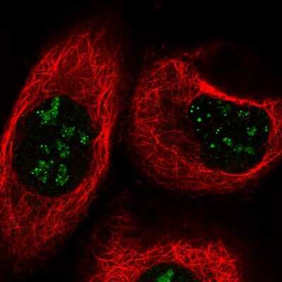 Immunocytochemistry/ Immunofluorescence: TBC1D13 Antibody [NBP1-92477]