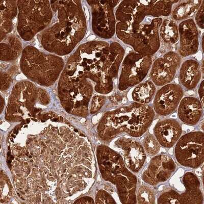 Immunohistochemistry-Paraffin: TBC1D13 Antibody [NBP1-92477]