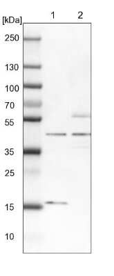 Western Blot: TBC1D13 Antibody [NBP1-92477]