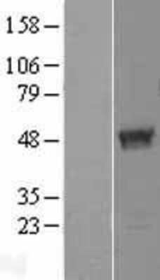 Western Blot: TBC1D13 Overexpression Lysate [NBP2-06857]