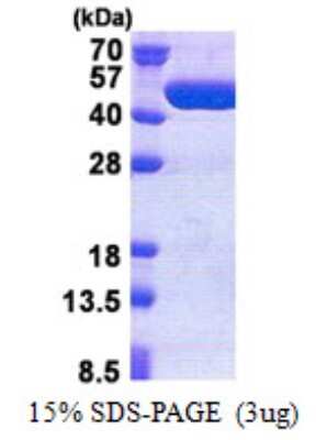 SDS-PAGE: Recombinant Human TBC1D13 His Protein [NBP2-22852]