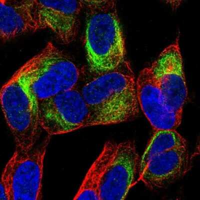 Immunocytochemistry/ Immunofluorescence: TBC1D16 Antibody [NBP2-57468]