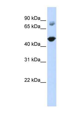 Western Blot: TBC1D16 Antibody [NBP1-55489]