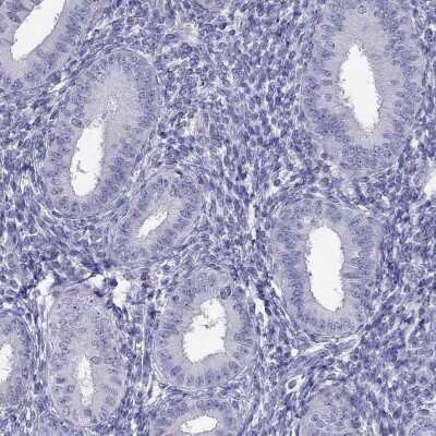 Immunohistochemistry-Paraffin: TBC1D21 Antibody [NBP1-92479]