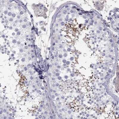 Immunohistochemistry-Paraffin: TBC1D21 Antibody [NBP1-92479]