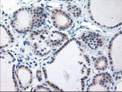 Immunohistochemistry: TBC1D21 Antibody (OTI2A6) - Azide and BSA Free [NBP2-74451]