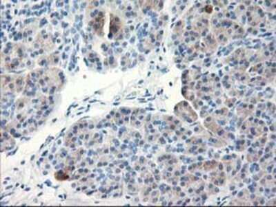 Immunohistochemistry: TBC1D21 Antibody (OTI2A6) - Azide and BSA Free [NBP2-74451]