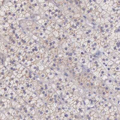 Immunohistochemistry-Paraffin: TBC1D22A Antibody [NBP1-86811]
