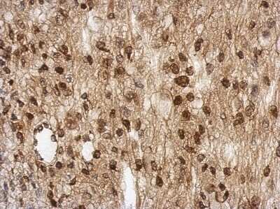 Immunohistochemistry-Paraffin: TBC1D22A Antibody [NBP2-20578]