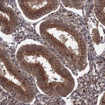 Immunohistochemistry-Paraffin: TBC1D23 Antibody [NBP1-90421]