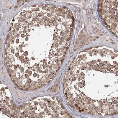Immunohistochemistry-Paraffin: TBC1D23 Antibody [NBP1-90421]
