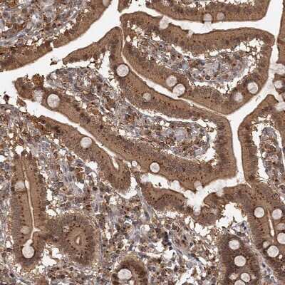 Immunohistochemistry-Paraffin: TBC1D23 Antibody [NBP1-90421]