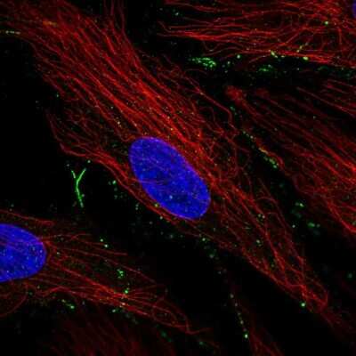 Immunocytochemistry/ Immunofluorescence: TBC1D24 Antibody [NBP2-57341]
