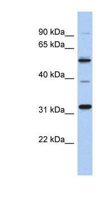 Western Blot: TBC1D26 Antibody [NBP1-57658]