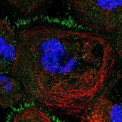 Immunocytochemistry/ Immunofluorescence: TBC1D30 Antibody [NBP1-93610]