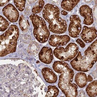 Immunohistochemistry-Paraffin: TBC1D30 Antibody [NBP1-93610]