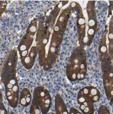 Immunohistochemistry-Paraffin: TBC1D32 Antibody [NBP1-90777]