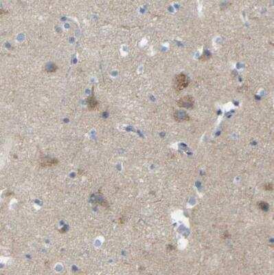 Immunohistochemistry-Paraffin: TBC1D32 Antibody [NBP1-90777]