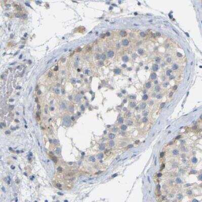 Immunohistochemistry-Paraffin: TBC1D32 Antibody [NBP1-90777]