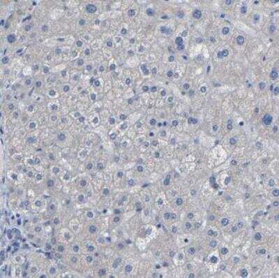 Immunohistochemistry-Paraffin: TBC1D32 Antibody [NBP1-90777]