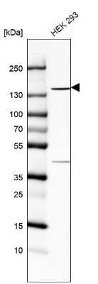 Western Blot: TBC1D32 Antibody [NBP1-90777]
