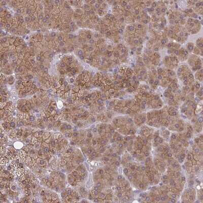 Immunohistochemistry-Paraffin: TBC1D4 Antibody [NBP2-38880]