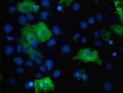 Immunocytochemistry/ Immunofluorescence: TBC1D4 Antibody (OTI5E6) - Azide and BSA Free [NBP2-74462]