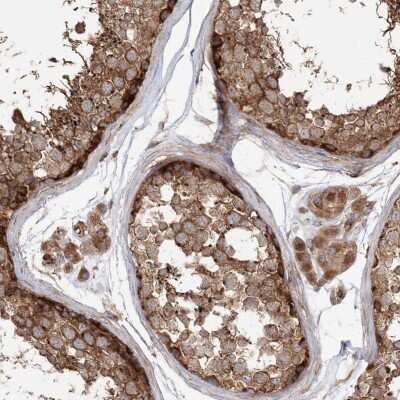 Immunohistochemistry-Paraffin: TBC1D5 Antibody [NBP2-38237]