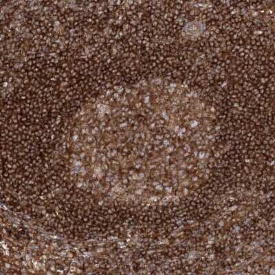 Immunohistochemistry-Paraffin: TBC1D5 Antibody [NBP2-38237]