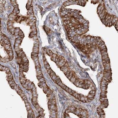 Immunohistochemistry-Paraffin: TBC1D5 Antibody [NBP2-38237]