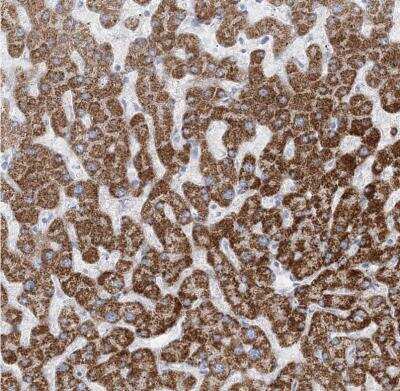 Immunohistochemistry-Paraffin: TBC1D7 Antibody [NBP1-84231]