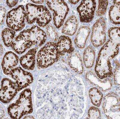 Immunohistochemistry-Paraffin: TBC1D7 Antibody [NBP1-84231]