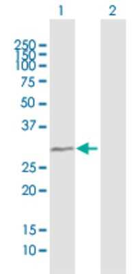 Western Blot: TBC1D7 Antibody [H00051256-B01P]