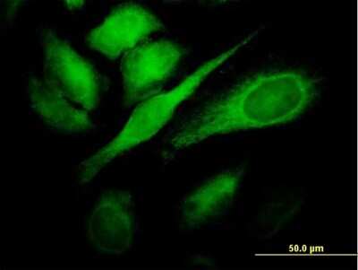 Immunocytochemistry/ Immunofluorescence: TBC1D8 Antibody (1A12) [H00011138-M02]