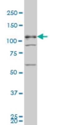 Western Blot: TBC1D8 Antibody (1A12) [H00011138-M02]